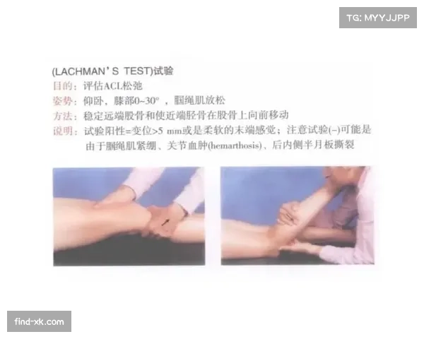 欧塞尔中场布阿伊长期伤缺 膝关节损伤康复已超过一年时间未愈